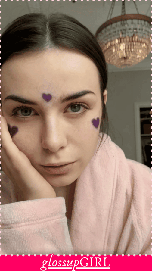 acne home hacks that clear skin overnight