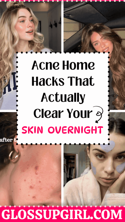acne home hacks that clear skin overnight