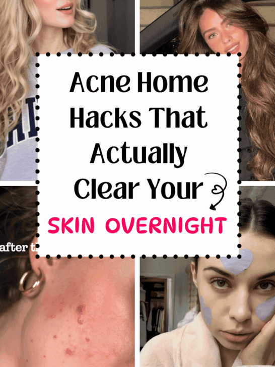 acne home hacks that clear skin overnight