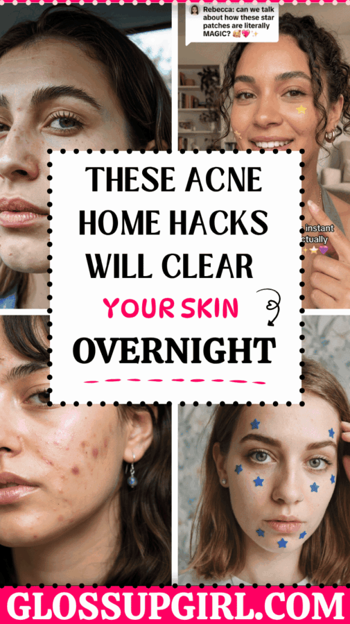 acne home hacks that clear skin overnight