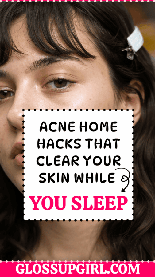 acne home hacks that clear skin overnight