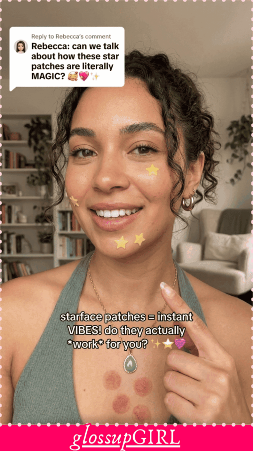 acne home hacks that clear skin overnight