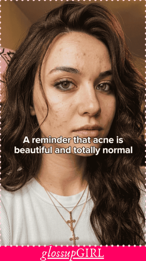 Overnight Pimple Fix