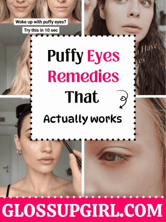 Puffy Eyes Remedies That Actually Work